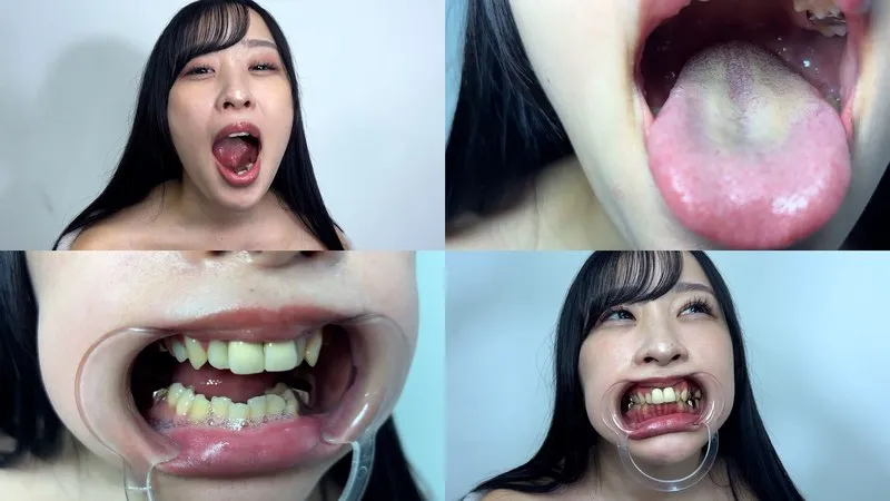NKO-700004 A look inside Yuno-chan's mouth, where her uvula is adorable.
