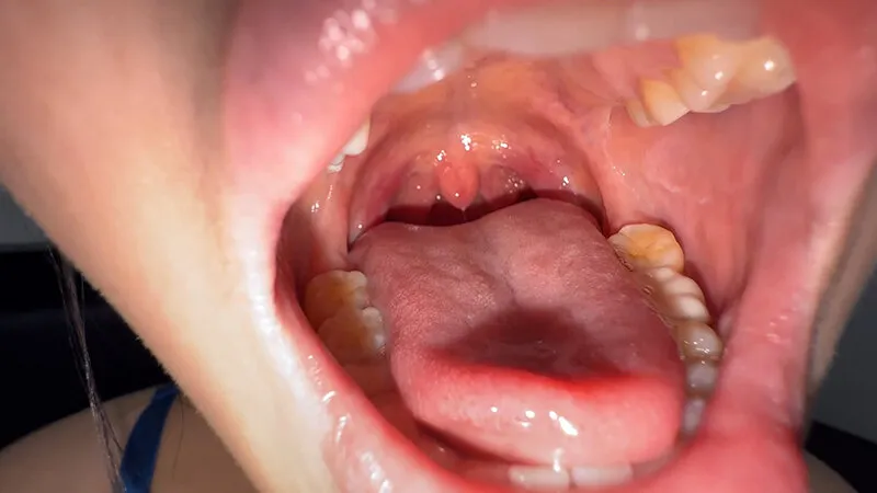 NKO-700001 Observing the inside of Suzu-chan's mouth as she drools profusely., screenshot 3